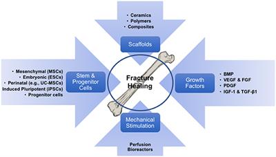 Tissue Engineering and Cell-Based Therapies for Fractures and Bone Defects